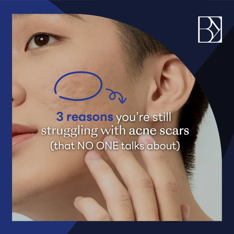 3 REASONS
