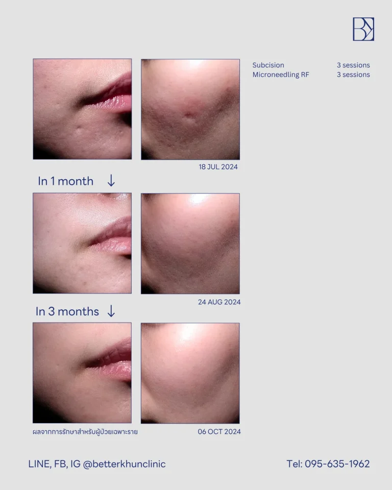 HN000507 K.ทิพย์สุดา