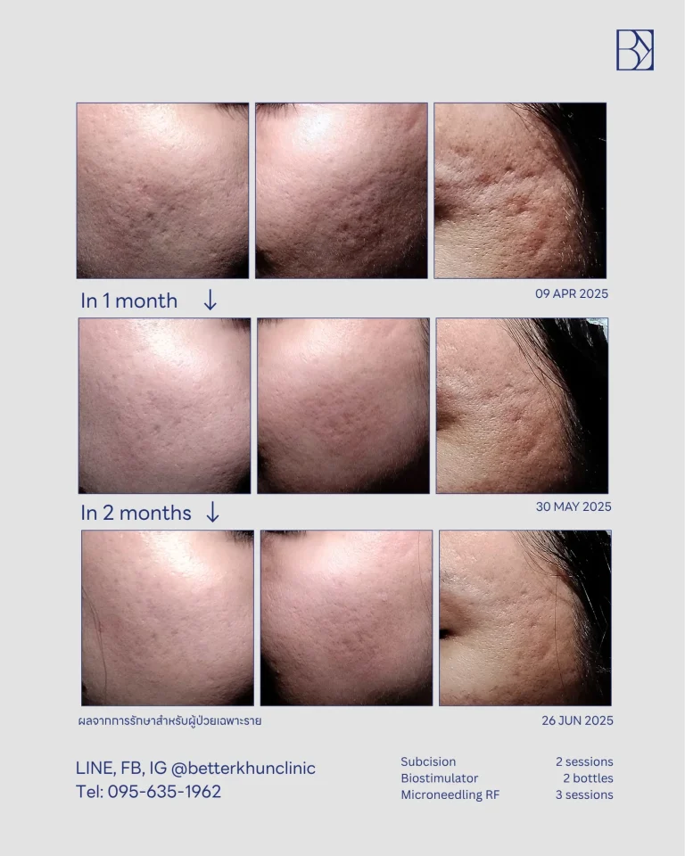 ภัทรศรี