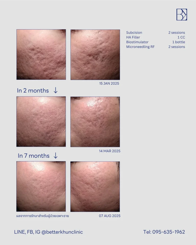 เขตโสภณ