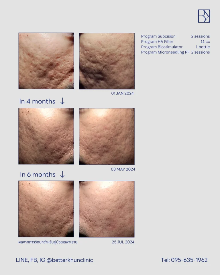 HN000042 คุณณัฐวัฒน์