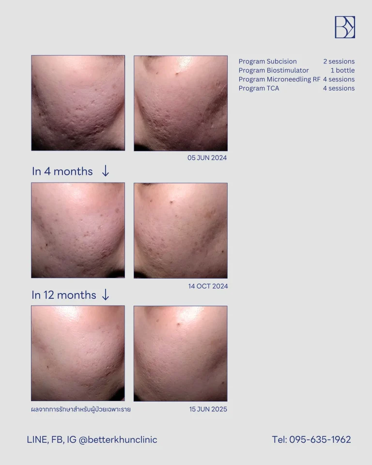 HN000383 วิภาวี