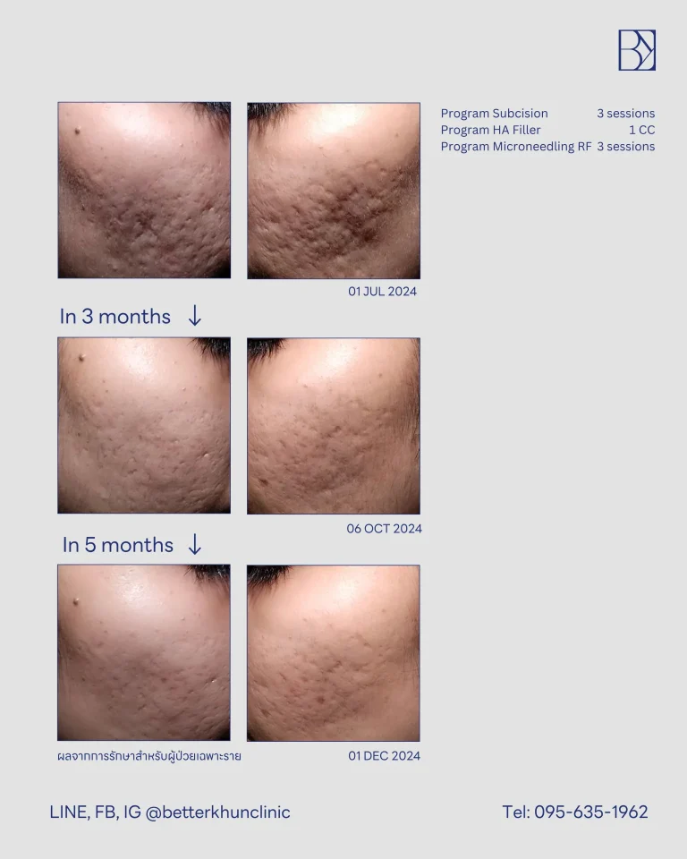 HN000444_ ณิชนภา มานะหฤทัย