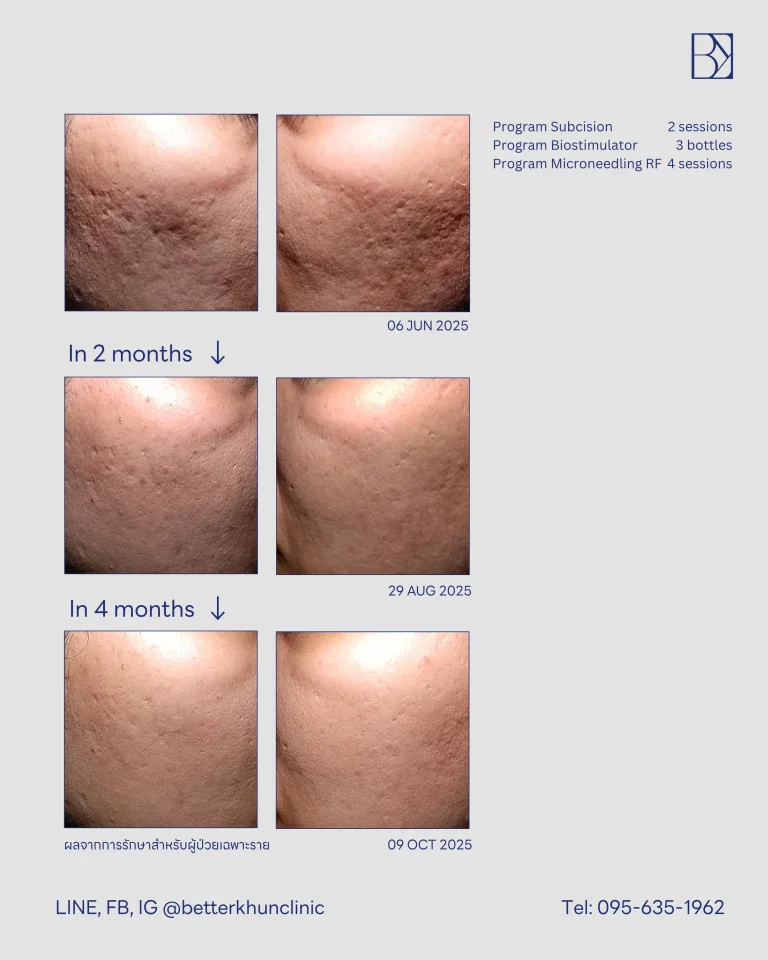 HN001172 K.สุพาณี